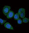 Acyl-CoA Synthetase Long Chain Family Member 4 antibody, abx031624, Abbexa, Immunohistochemistry paraffin image 