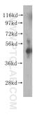 Zinc Finger Protein 2 antibody, 11282-1-AP, Proteintech Group, Western Blot image 