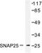 Synaptosome Associated Protein 25 antibody, LS-C176211, Lifespan Biosciences, Western Blot image 