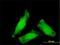 NIPBL Cohesin Loading Factor antibody, H00025836-M01, Novus Biologicals, Immunocytochemistry image 