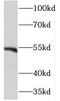 NIMA Related Kinase 11 antibody, FNab05650, FineTest, Western Blot image 