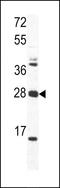 Ornithine decarboxylase antizyme 1 antibody, GTX81427, GeneTex, Western Blot image 