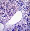 Patatin Like Phospholipase Domain Containing 4 antibody, LS-C163826, Lifespan Biosciences, Immunohistochemistry frozen image 