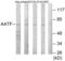 Apoptosis Antagonizing Transcription Factor antibody, abx013816, Abbexa, Western Blot image 