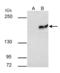 SET Domain Bifurcated Histone Lysine Methyltransferase 1 antibody, GTX115305, GeneTex, Immunoprecipitation image 