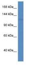 Patatin Like Phospholipase Domain Containing 6 antibody, NBP1-74214, Novus Biologicals, Western Blot image 