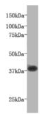 LPAR1 antibody, MBS857126, MyBioSource, Western Blot image 