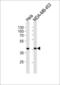 Calponin 1 antibody, GTX81714, GeneTex, Western Blot image 