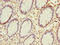 N-Acetyltransferase 2 antibody, CSB-PA015471LA01HU, Cusabio, Immunohistochemistry paraffin image 