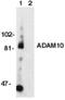 ADAM Metallopeptidase Domain 10 antibody, PA1-30676, Invitrogen Antibodies, Western Blot image 