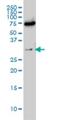 Exosome Component 8 antibody, H00011340-M01, Novus Biologicals, Western Blot image 