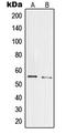 Pre-MRNA Processing Factor 19 antibody, LS-C353405, Lifespan Biosciences, Western Blot image 