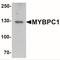 Myosin Binding Protein C, Slow Type antibody, NBP2-41157, Novus Biologicals, Western Blot image 