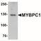 Slow MyBP-C antibody, NBP2-41157, Novus Biologicals, Western Blot image 