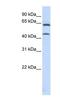 Chondroitin Sulfate N-Acetylgalactosaminyltransferase 1 antibody, NBP1-59219, Novus Biologicals, Western Blot image 