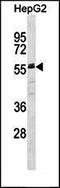 B-Raf Proto-Oncogene, Serine/Threonine Kinase antibody, orb216036, Biorbyt, Western Blot image 