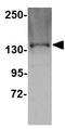 Tau Tubulin Kinase 1 antibody, GTX85349, GeneTex, Western Blot image 