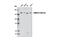 SWI/SNF Related, Matrix Associated, Actin Dependent Regulator Of Chromatin Subfamily C Member 1 antibody, 9053S, Cell Signaling Technology, Western Blot image 