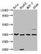 Aminoacyl TRNA Synthetase Complex Interacting Multifunctional Protein 1 antibody, CSB-PA618638EA01HU, Cusabio, Western Blot image 