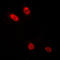 CCAAT Enhancer Binding Protein Delta antibody, LS-C351982, Lifespan Biosciences, Immunofluorescence image 