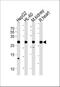 ATP Synthase Peripheral Stalk-Membrane Subunit B antibody, A32374-1, Boster Biological Technology, Western Blot image 