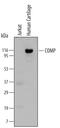 Cartilage Oligomeric Matrix Protein antibody, MAB31341, R&D Systems, Western Blot image 