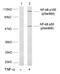 Nuclear Factor Kappa B Subunit 2 antibody, GTX79001, GeneTex, Western Blot image 