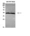 ER Lipid Raft Associated 1 antibody, STJ98620, St John