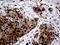 Transaldolase 1 antibody, LS-C799049, Lifespan Biosciences, Immunohistochemistry paraffin image 