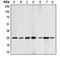 BCL2 antibody, GTX55105, GeneTex, Western Blot image 