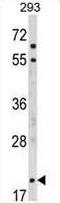 Myelin Associated Oligodendrocyte Basic Protein antibody, GTX81655, GeneTex, Western Blot image 