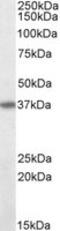 FAS antibody, MBS421960, MyBioSource, Western Blot image 