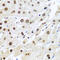 Methyltransferase Like 3 antibody, A01758, Boster Biological Technology, Immunohistochemistry paraffin image 