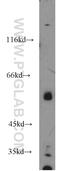 Oxysterol Binding Protein Like 2 antibody, 17217-1-AP, Proteintech Group, Western Blot image 