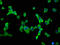 Sodium Voltage-Gated Channel Alpha Subunit 10 antibody, LS-C673682, Lifespan Biosciences, Immunofluorescence image 