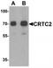 CREB Regulated Transcription Coactivator 2 antibody, TA320138, Origene, Western Blot image 