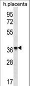 Olfactory Receptor Family 8 Subfamily D Member 4 antibody, LS-C163255, Lifespan Biosciences, Western Blot image 