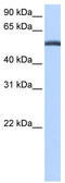 Lactamase Beta antibody, TA340212, Origene, Western Blot image 