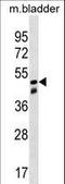 Sorting Nexin 8 antibody, LS-C159060, Lifespan Biosciences, Western Blot image 