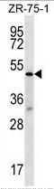 Transducin beta-like protein 2 antibody, AP54181PU-N, Origene, Western Blot image 