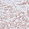 Transforming Growth Factor Beta Receptor 2 antibody, LS-C747135, Lifespan Biosciences, Immunohistochemistry paraffin image 