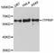 Inositol 1,4,5-Trisphosphate Receptor Interacting Protein antibody, A11725, ABclonal Technology, Western Blot image 