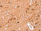 Neutral Cholesterol Ester Hydrolase 1 antibody, CSB-PA063661, Cusabio, Immunohistochemistry paraffin image 