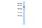 Zinc Finger Protein 454 antibody, A17054, Boster Biological Technology, Western Blot image 