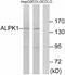 Alpha-protein kinase 1 antibody, A08171, Boster Biological Technology, Western Blot image 