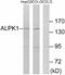 Alpha Kinase 1 antibody, A08171, Boster Biological Technology, Western Blot image 