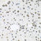 Histone Deacetylase 3 antibody, STJ114416, St John