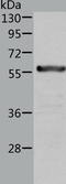 Aldehyde Dehydrogenase 6 Family Member A1 antibody, TA324300, Origene, Western Blot image 