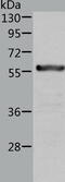 Aldehyde Dehydrogenase 6 Family Member A1 antibody, TA324300, Origene, Western Blot image 