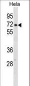 Cleavage And Polyadenylation Specific Factor 6 antibody, LS-C157659, Lifespan Biosciences, Western Blot image 